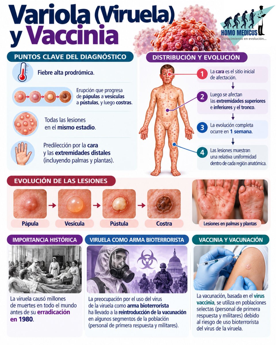 ENARM_intensivo's tweet photo. 💢VIRUELA

#ENARM_INTENSIVO #ESTUDIA_MEDICINA https://t.co/zmpHsX85O2