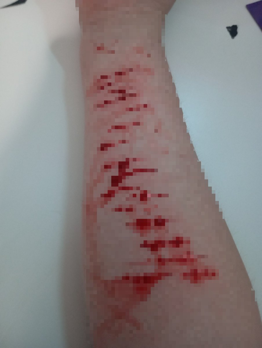 evaanivivi's tweet photo. Bloody paradise! >< !! Halloween makeup!! https://t.co/DsBE0STHkW