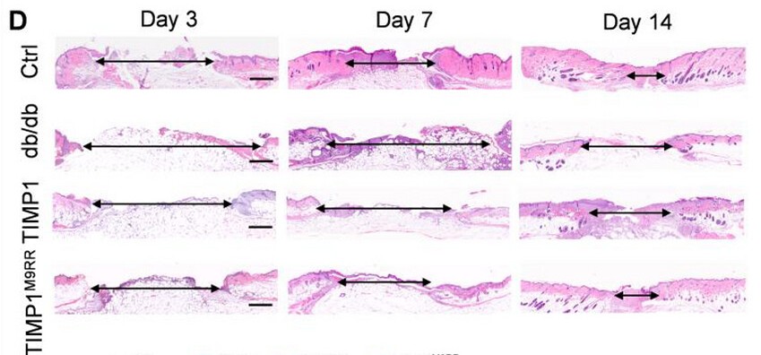 DermalCell's tweet photo. Researchers from @CUHKofficial introduced an MMP-9-responsive protein release system as a precise, adaptive therapeutic strategy for #DiabeticFootUlcer. 👣 

Read the #OpenAccess article published in Advanced Science (@AdvPortfolio): https://t.co/UqJ55087mV https://t.co/Tb6e1AcOvL
