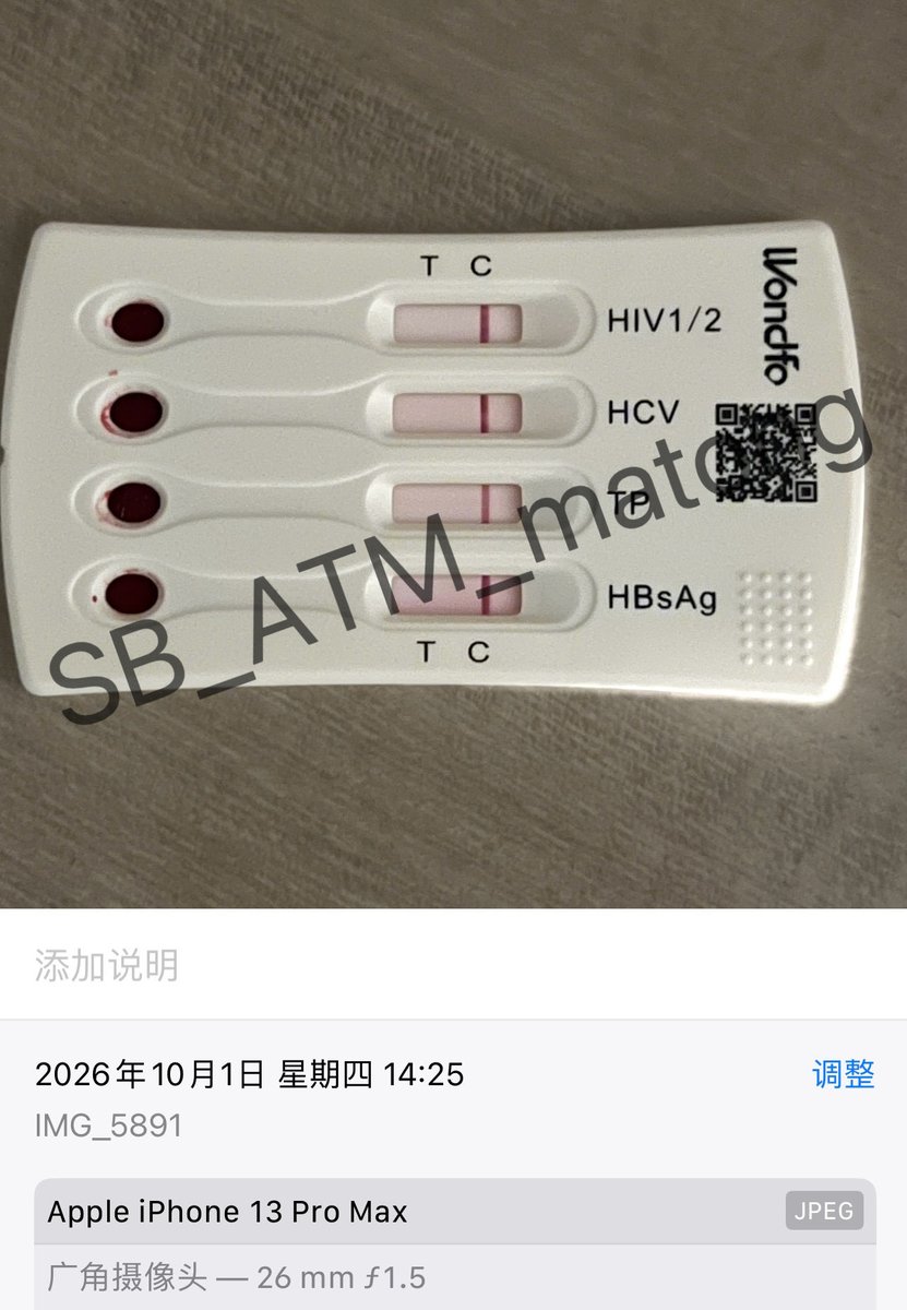 SB_ATM_matong's tweet photo. 放心肉  放心吃🤔 https://t.co/BWtcD7OgHB