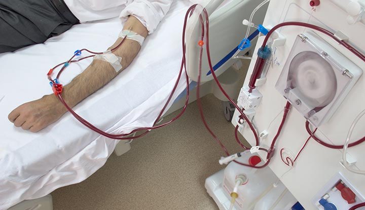 md1talk's tweet photo. سؤال راوند: 

هل نقدر نستخدم ACE/ARBs في ESRD على غسيل كلوي ؟؟ https://t.co/A76QIqdVS5