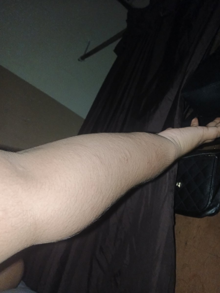jerdiksz2's tweet photo. gate bgt anjg pdhl sepre udh ganti, mandi dah bersih tpi ttp gatel bgttt ini penyakit apasihh namanya? https://t.co/djP8yLhuhx