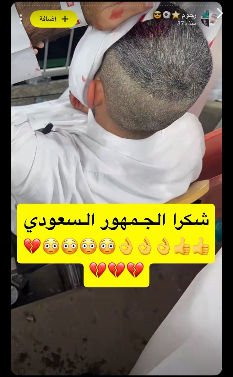 ZXl37's tweet photo. @Ali2005_SR4 @eontavr @ltsnnoo @thismaybe77 عشان ادشش السيف بطيىرْك https://t.co/GrVkLE6c38