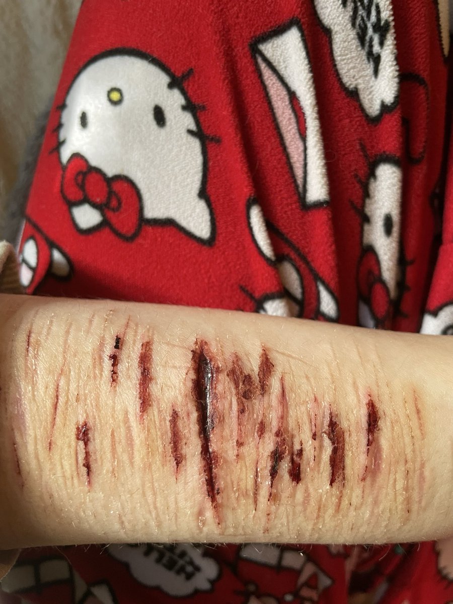 mothbunnny's tweet photo. um haha so like on a scale of 1 - 10 how likely is this to get infected 🥰🥰

all halloween gore makeup lalalalala totally yesyesyes

#shedrtwt #slittwt #slashtwt #sharmtwt #shhtwt #ouchietwt https://t.co/B5vVbXyOOi