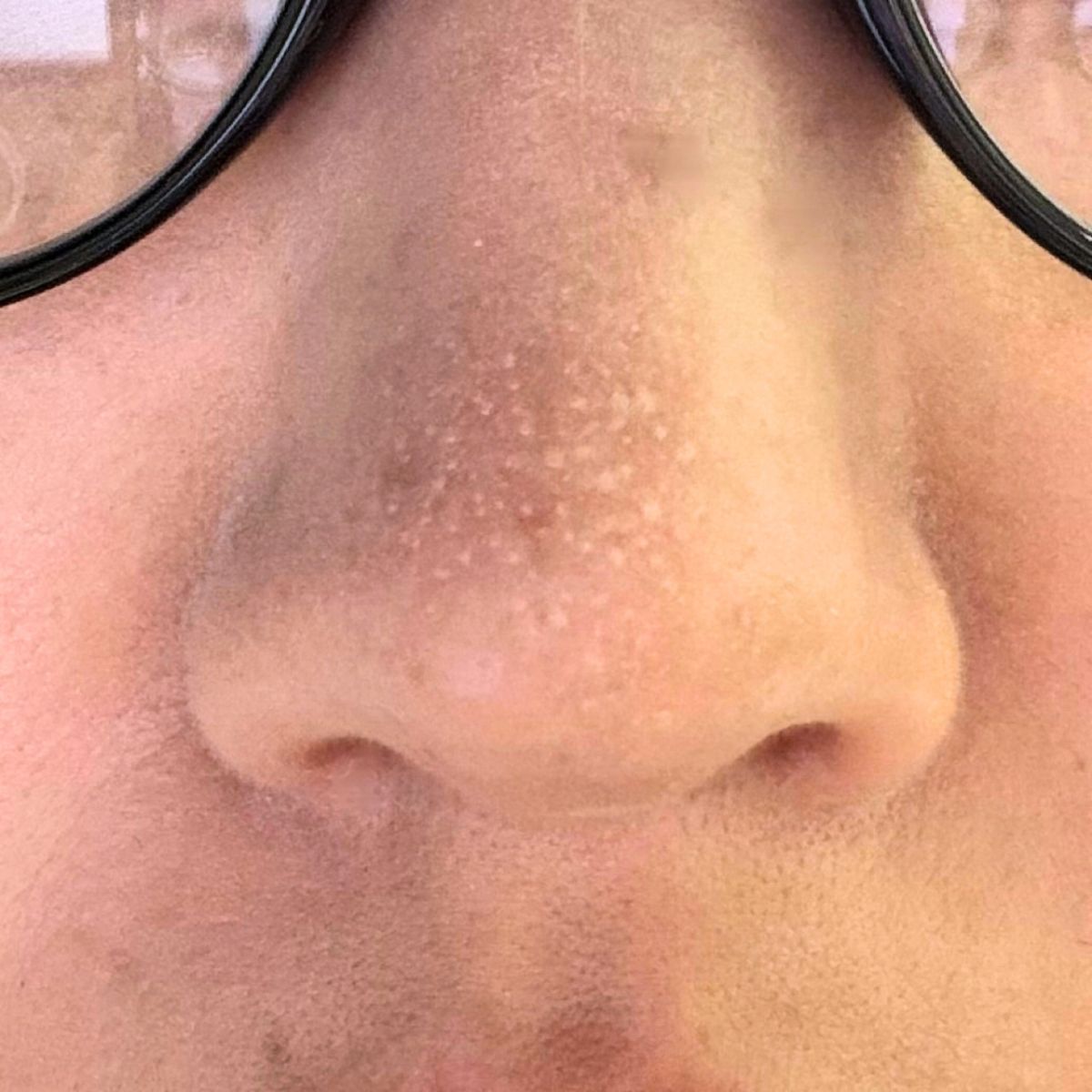 wagyu_sou's tweet photo. 夏あれだけ皮脂ドパやったのに急に乾燥してきて化粧ノリこれなんですけど。水洗顔→化粧水→乳液→下地→コンシーラー→ファンデの工程です。私も下地抜けば良いんだろうか…TT
https://t.co/en7a5FaNFB https://t.co/sCrfctZHRa