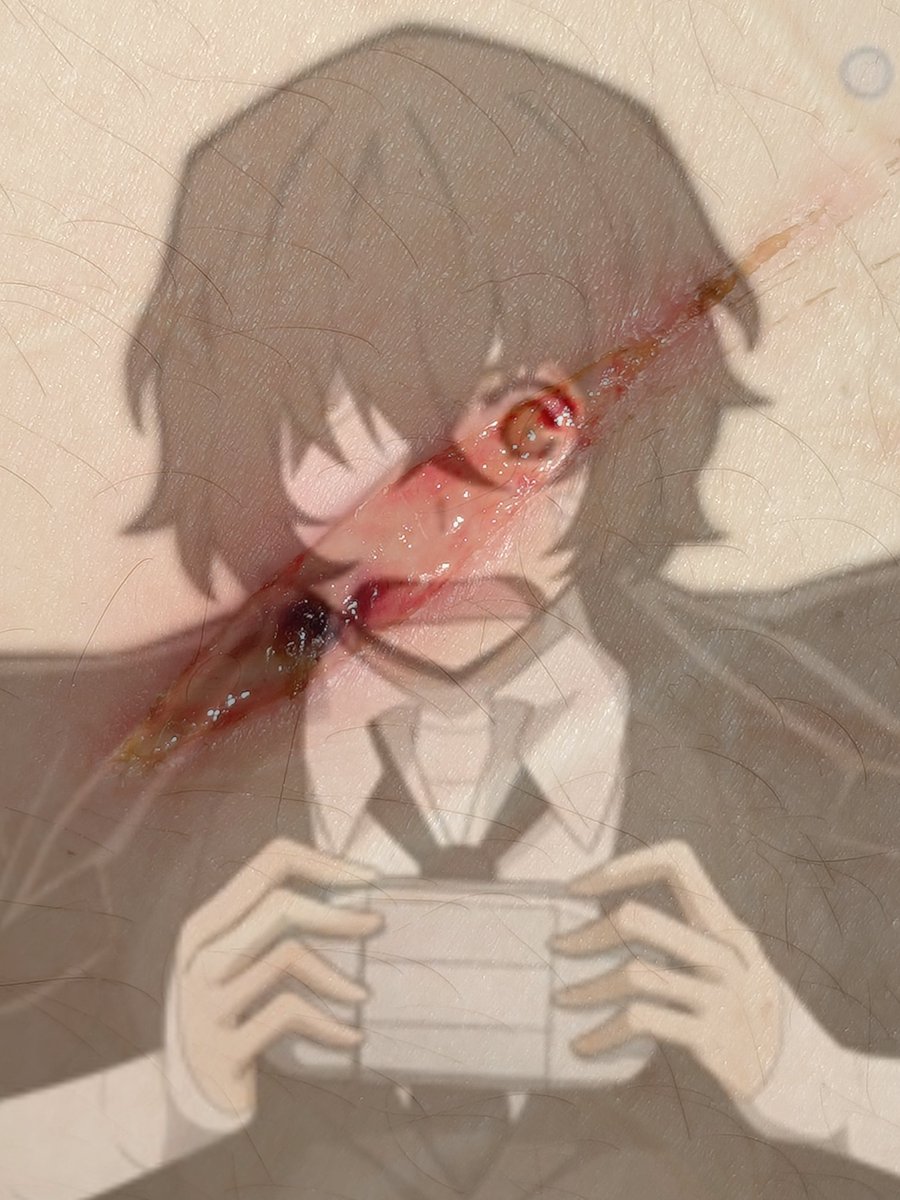 08dogheaven's tweet photo. the red spot is likely dried strawberry juice, yummy 🍓 (the infection seems to be getting better) https://t.co/vsWHrnYSqW