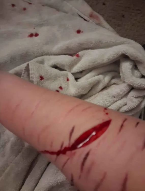 Bubbles313359's tweet photo. reupload of mY COMPLETELY AI GENERATED SFX MAKEUP. MOVIE PRACTICE
one swipe deep beans btw
------------------
#slittwt #shtwt #988twt https://t.co/TLa23MenOi
