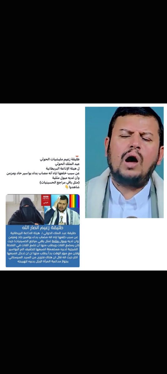 fahaD7tl's tweet photo. @Sultanasdeh30 والله ثم والله ثم والله ان الدعس المبرم جايكم والموت والمصير الأسود بيغطيكم وتتمنون أنكم ماخلقتم لا حوثي بعد اليوم https://t.co/BbngrtrvHX