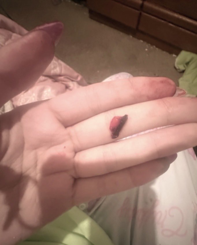 kittiifetti's tweet photo. black thing i cut out from my cut???? https://t.co/XTgnKrncwC
