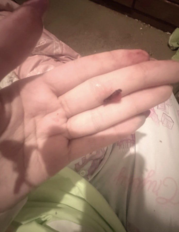 kittiifetti's tweet photo. black thing i cut out from my cut???? https://t.co/XTgnKrncwC