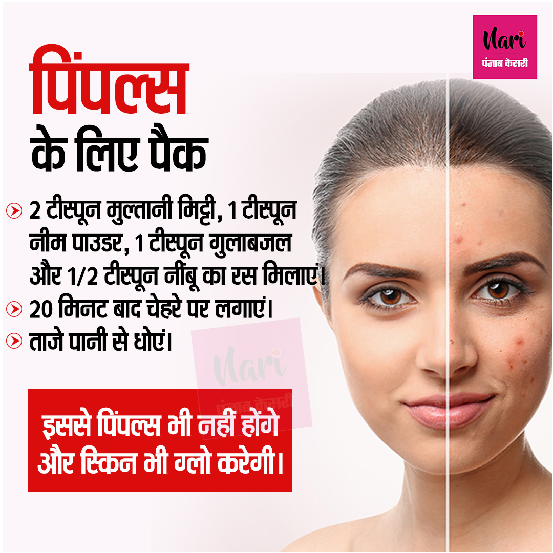 NariKesari's tweet photo. पिंपल्स के लिए पैक
#Pimple #Skincare #NeemBenefits #Beauty https://t.co/lIl9RkKRMX