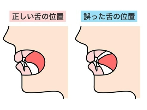 nya22_co's tweet photo. 横顔自信ない…って人コレやって‼️
舌を正しい位置に戻す���とで二重顎も消えてみるみるフェイスライン整って自信持てるようになる‼️ https://t.co/Hxu89zAsXc