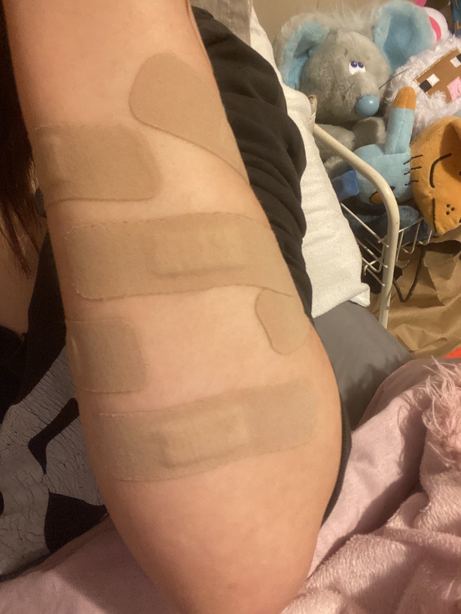 Madis_worlds's tweet photo. “Yo who used all the bandaids?” Uhhh https://t.co/Gt9UKcyUwS