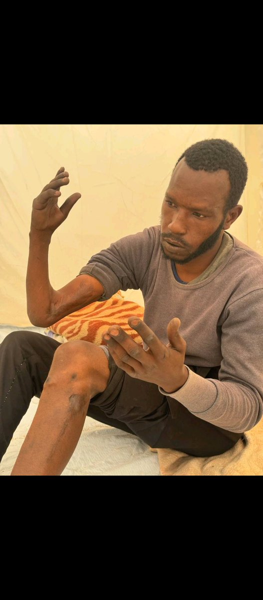 RamiUbaid97990's tweet photo. I will not forgive or pardon anyone who sees my suffering, my disability, and my condition and ignores me. I am a marginalized, abandoned, Black Palestinian. No one looks at me with mercy. I am very tired, but I am patient and hopeful. 
https://t.co/E7TbF8Pshx https://t.co/UgmS9TJmXi