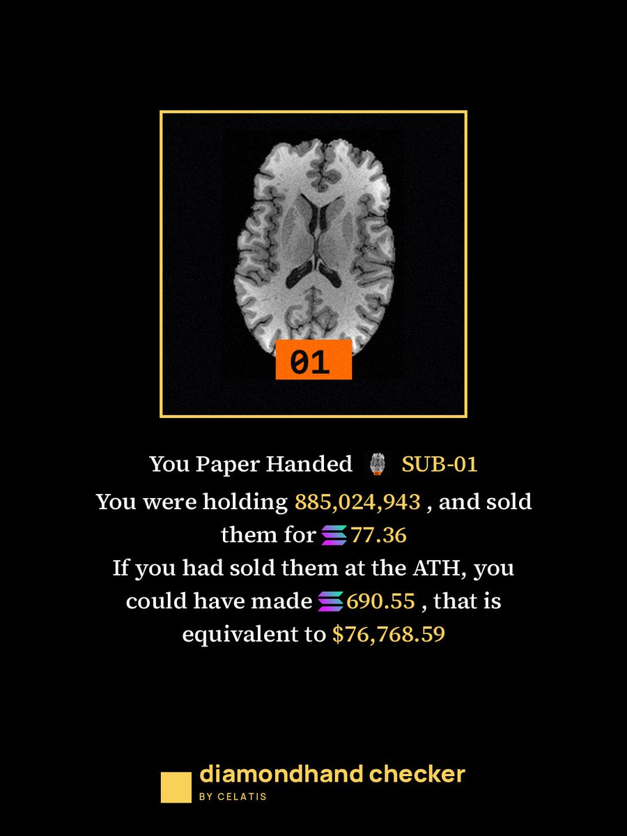 sumeraashfaq's tweet photo. When will I learn to hold cry 😭

Sold $SUN-01 (6WCtKQfkWurd77tCCAYWuL5TwyAvuovTzworfnfupump)  

https://t.co/X4PGdqrmG3 https://t.co/syatKKen9y