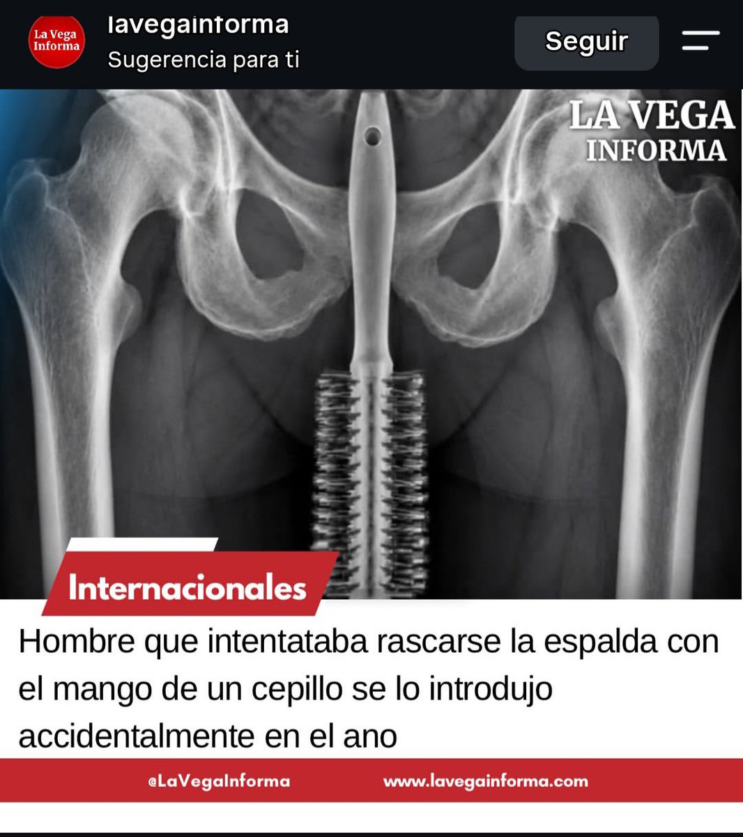 pierrotswife33's tweet photo. Que casualidad no? https://t.co/rOwcjc0uFh