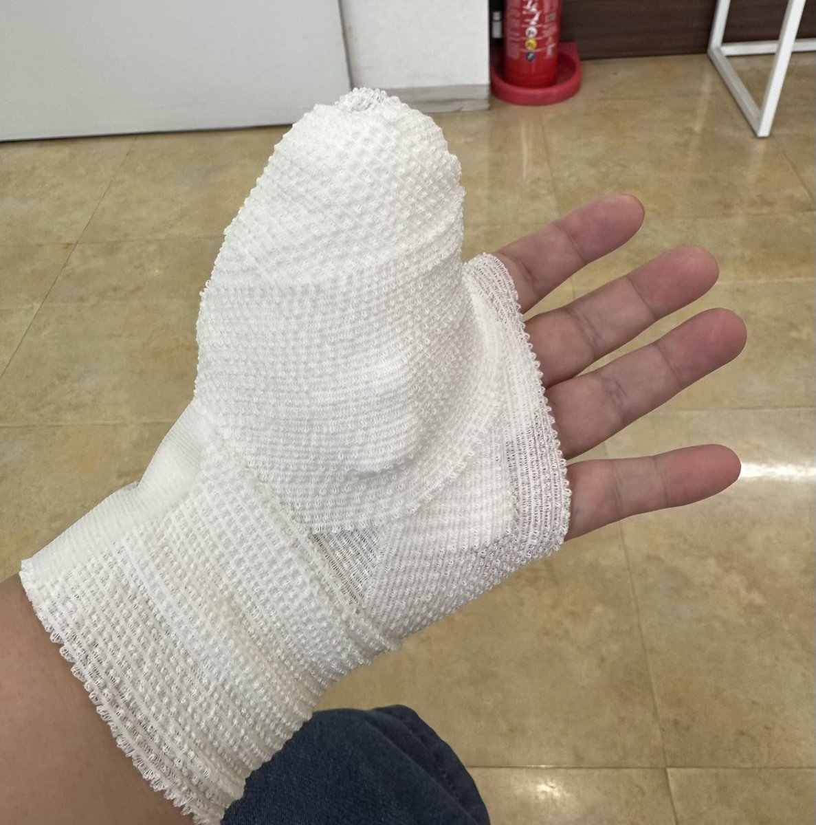 uuiioiaio's tweet photo. 数日前ばね指の手術してきた。術後の包帯の巻き方やばいよね🤭 https://t.co/mUgXDRKIC0