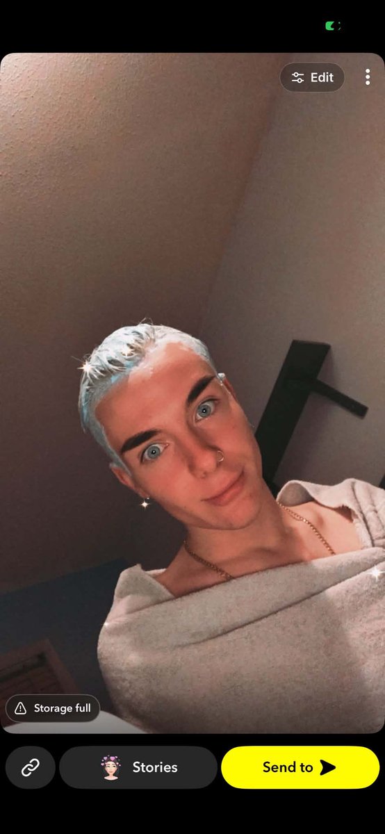 thewinterdollx's tweet photo. This is your sign to transition if you’ve been questioning it! I went from a masculine man to a biological female 💗 HRT will irreversibly change your DNA, sex and chromosomes! (big W) https://t.co/9u4uiQndGH