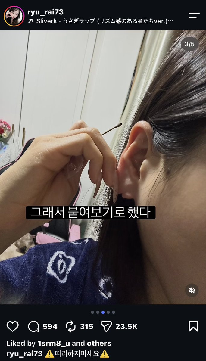sorrysinu's tweet photo. 아니 류라이 미친거아님? 귀 찢어진거 순간접착제로 붙였대 ㅅㅂ https://t.co/vf5rQxGKfc