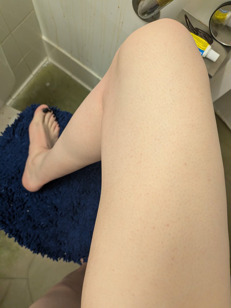 Steph24124's tweet photo. Leg and foot 😅 
#fetish, #feet, #LGBTQCommunity #leg https://t.co/CJOjQ5k7Fi