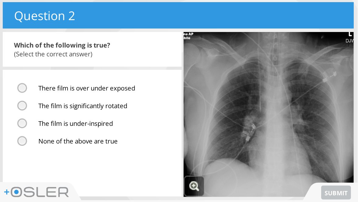 oslertech's tweet photo. Master the Chest X-ray with this incredible free module series on Osler:
Structured approach; Consolidation; Collapse; Cardiac Pathology; Pneumothorax; Equipment
Start here with Basic Interpretation: https://t.co/Q3joIzc9iF
#juniordoctors #medstudents #medicalstudents #FOAMed #meded #tipsfornewdocs #medtwitter