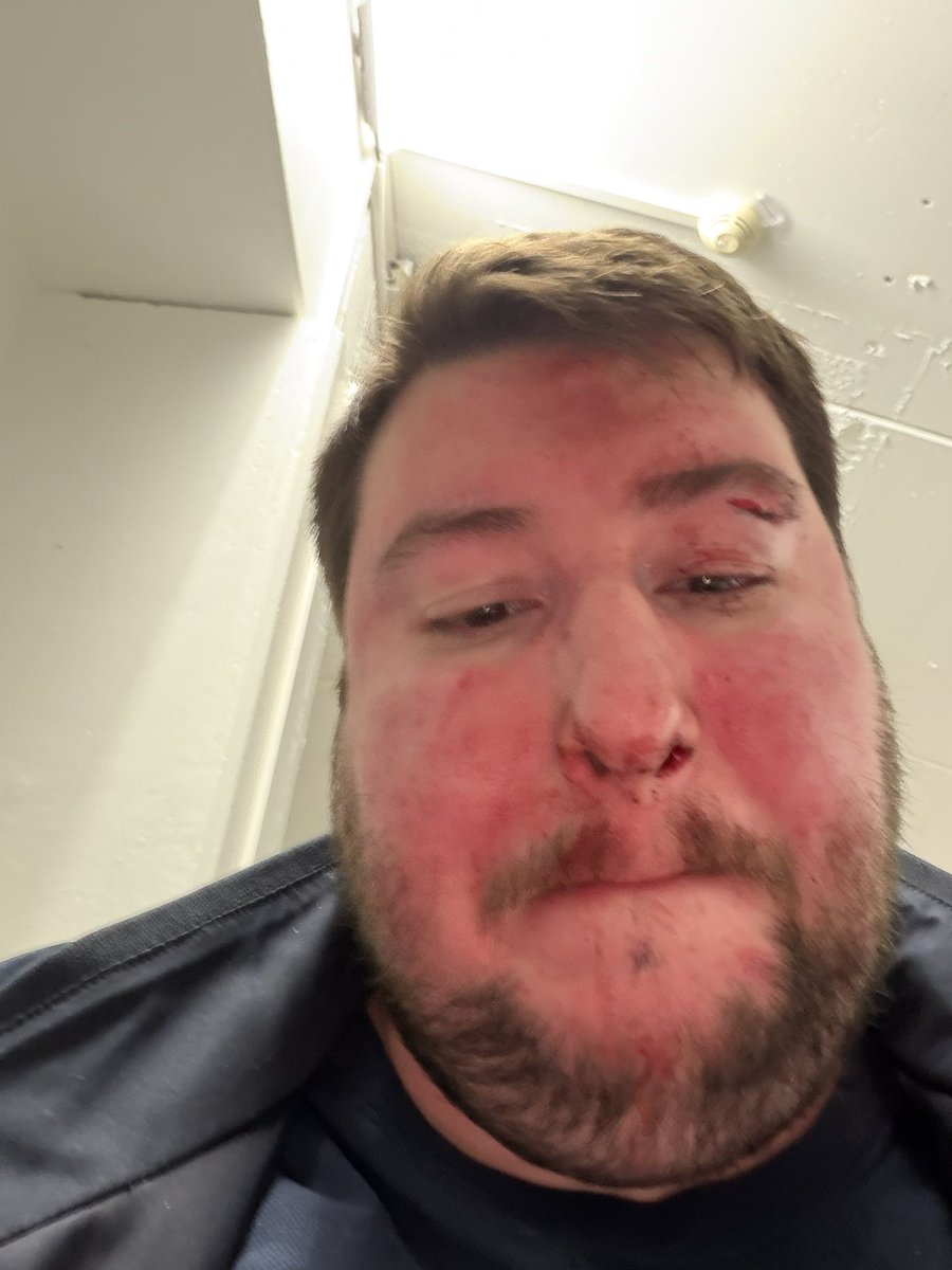 MoonBatRise's tweet photo. J’ai été aggressé à mon cinéma, lors de la rediffusion d’Avengers Endgame Encore car j’ai demander à quelqu’un d’arrêter son téléphone au cinéma et il m’as violament frappé @comics_tracker 
#Cinema https://t.co/wfzHIIrNv1
