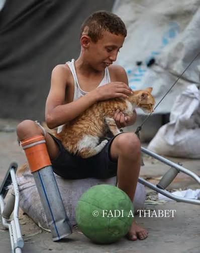 natjiushka_2's tweet photo. A que esta fotografía de un niño mutilado por Israel tendrá más likes y RT que esta bazofia sionista https://t.co/wFBtBpGCE0