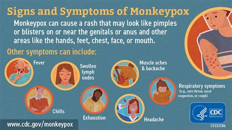 WooodChuckWould's tweet photo. @nypost Some are saying James Talarico could be stricken with monkeypox, preventing him from even Zoom appearances. The pox is spread through physical contact with the infected. It's a disfiguring condition.

Best of luck with a quick recovery. https://t.co/5nHqEml8DU