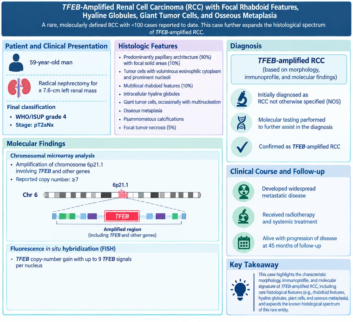 IJSPjournal's tweet photo. #GUPath read of the day in IJSP ➡️ Expanding the histologic spectrum of TFEB-amplified RCC to include rhabdoid features, among others.
Check it out 👉🏼 https://t.co/OFhGFoXovs
#PathTwitter #PathX https://t.co/rs67ZR13F7