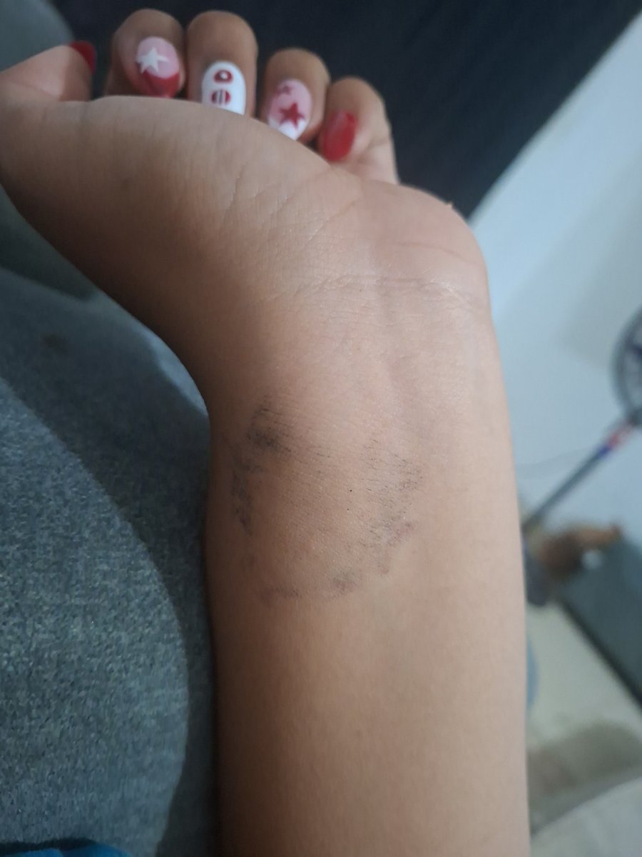 uncivilizedLIXY's tweet photo. Esa yo con un tatuaje de yoongi, ya intente todo y aún sigue ahí https://t.co/EGc7JElEDJ