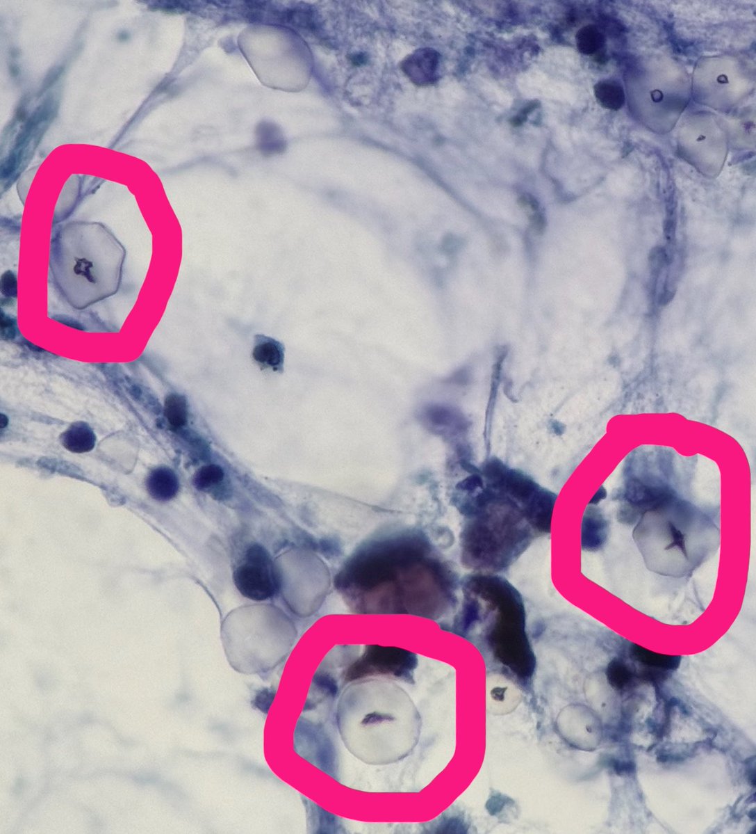 PathologyKate's tweet photo. What are these? @yro854 https://t.co/JcNJiS2SVR
