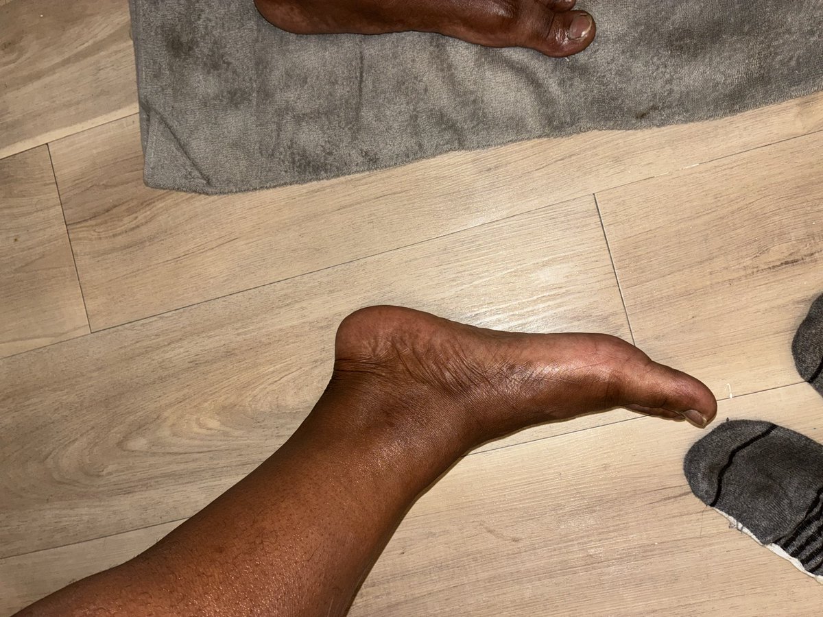 pbanksssss70552's tweet photo. #feetfetısh #footfetısh #feetworshi̇p #feet #foot #toes #FeetOfTheDay https://t.co/hC8egnv0cg