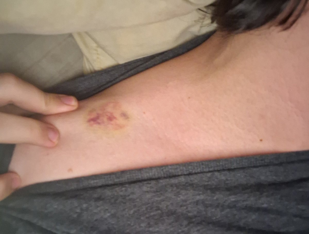 SLudow's tweet photo. this means i am marked? https://t.co/gYL1C34YPC