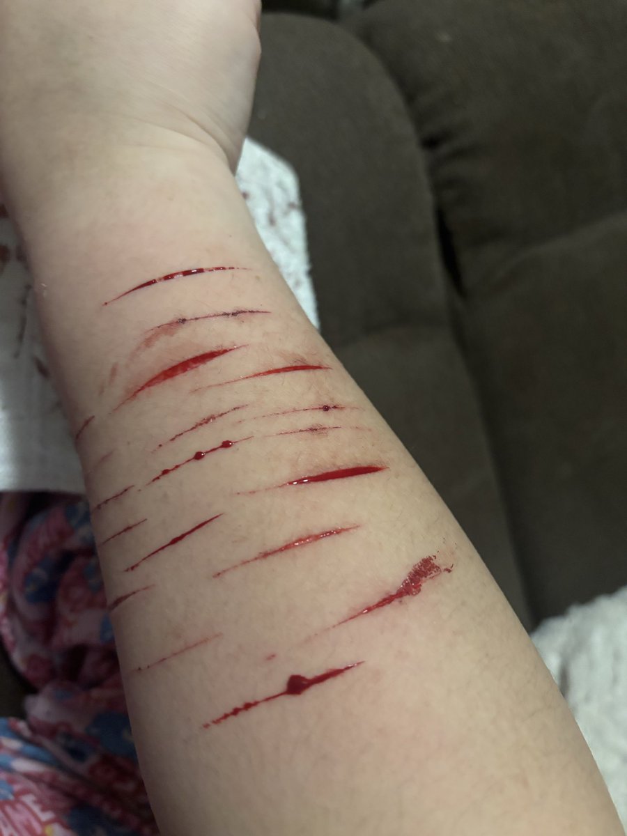 Autistic_Hoe69's tweet photo. The walking larp (SFX MAKEUP!! Horror movie I'm working on!)  #shedtwt #SFX #slittwt https://t.co/onGM9byicG
