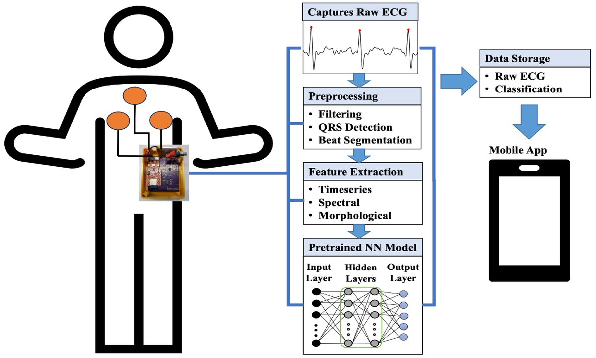 ElectronicsMDPI's tweet photo. ๐#EditorsChoicePaper!
โResource-Constrained On-Chip AI Classifier for Beat-by-Beat Real-Time Arrhythmia Detection with an ECG Wearable System
๐ Read at: https://t.co/0coEaXVJGk
#electrocardiogram #lightweightmodel #arrhythmiaclassification
#wearable #realtime #ECG #QRS #ANN https://t.co/CStwQKkDQ9