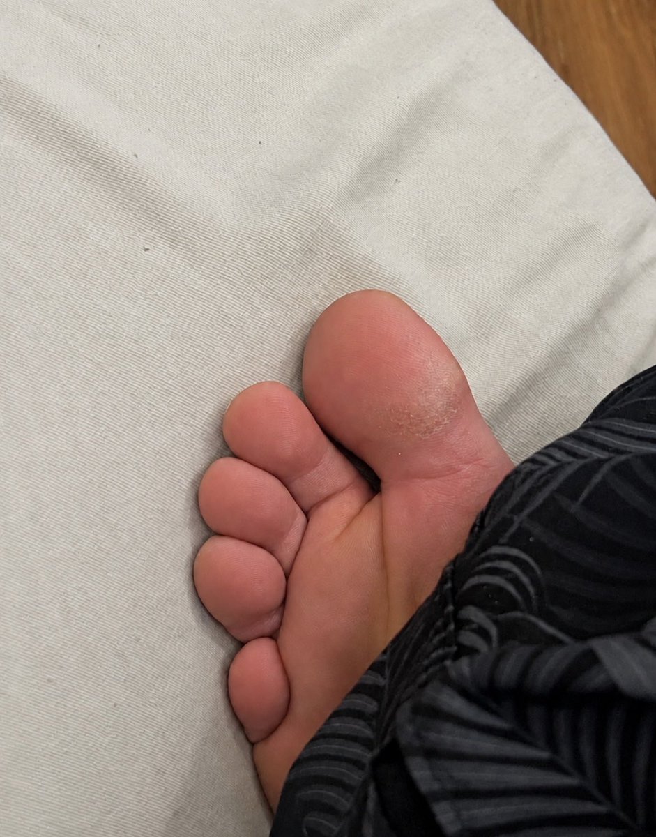 pgmmgsp18's tweet photo. Vem terminar sua noite e se perder no pezão aqui! 🥵👅😈🦶🏻 

#PésMasculinos #PésBonitos #FootFetish #FeetLovers #FootFans #Pés #FotosDePés #FeetPics #FeetContent #FootModel #SolaDosPés #ConteúdoExclusivo #PackDePés #VendaDeFotos #FeetForSale #BrazilianFeet #findom #cashmaster https://t.co/U0omgKlZYB