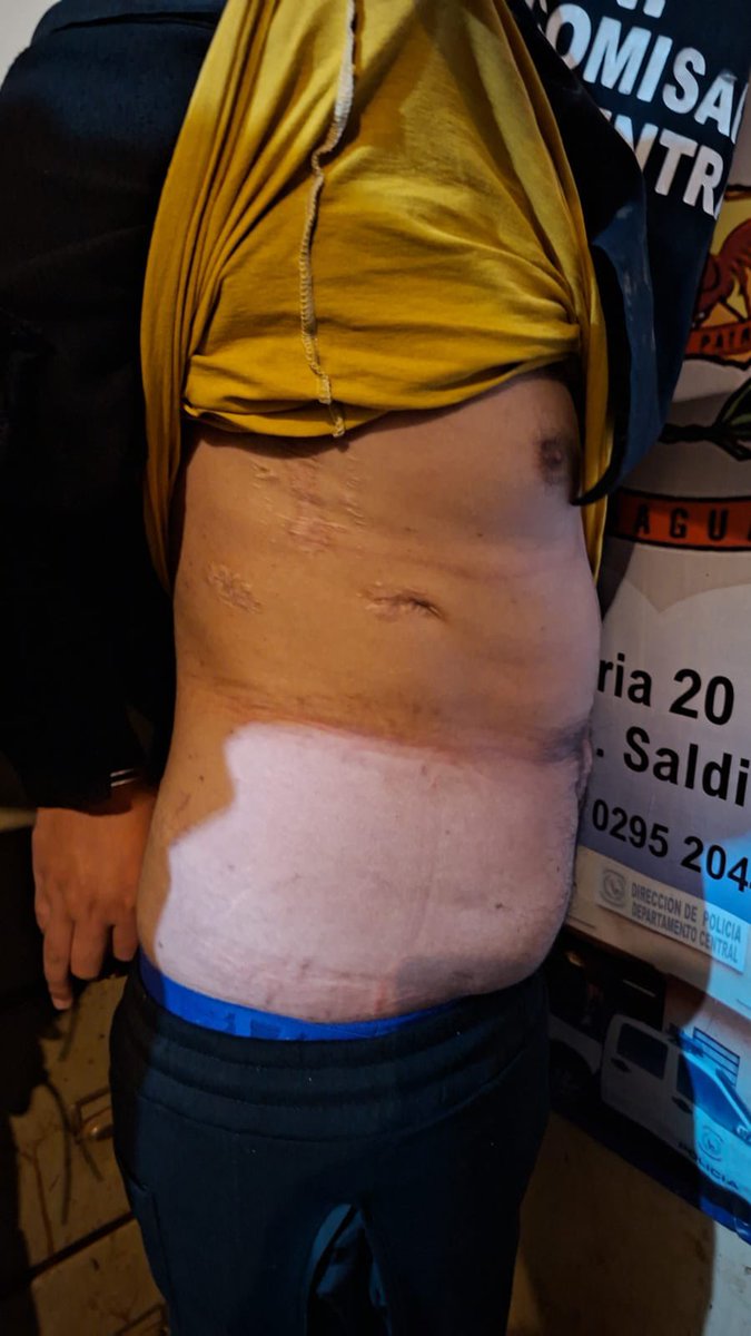 Raulbogarin's tweet photo. 🚨SE ENTREGÓ EL FEMINICIDA DE DEISY PAOLA.

-Aldo Alexis Duarte (26) se presentó en la Comisaría 20.ª Central, confirmó el comisario Ulises Portillo.
-Está señalado como autor del asesinato de su expareja, Deisy Paola Giménez Segovia (22), ocurrido el jueves en Lambaré. 

📍 Comisaría 20.ª Central, J. Augusto Saldívar.