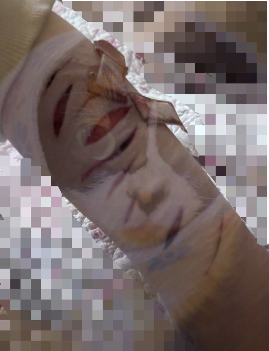 onlykuki's tweet photo. Shrunk so much in the span of 2 days im so 😡😡😡😡😡😡😡😡😡😡😡😡🤬😡😡😡🤬🤬😡😡😡😡😡😡😡😡😡😡😡😡😡😡😡😡😡😡😡😡
🐟
HEALED sfx that Isn’t real ☝️ and Fake ☝️ and not real ☝️ and ai ☝️ 
#shedrtwt #988twt #sfx https://t.co/CFawn0qyXM