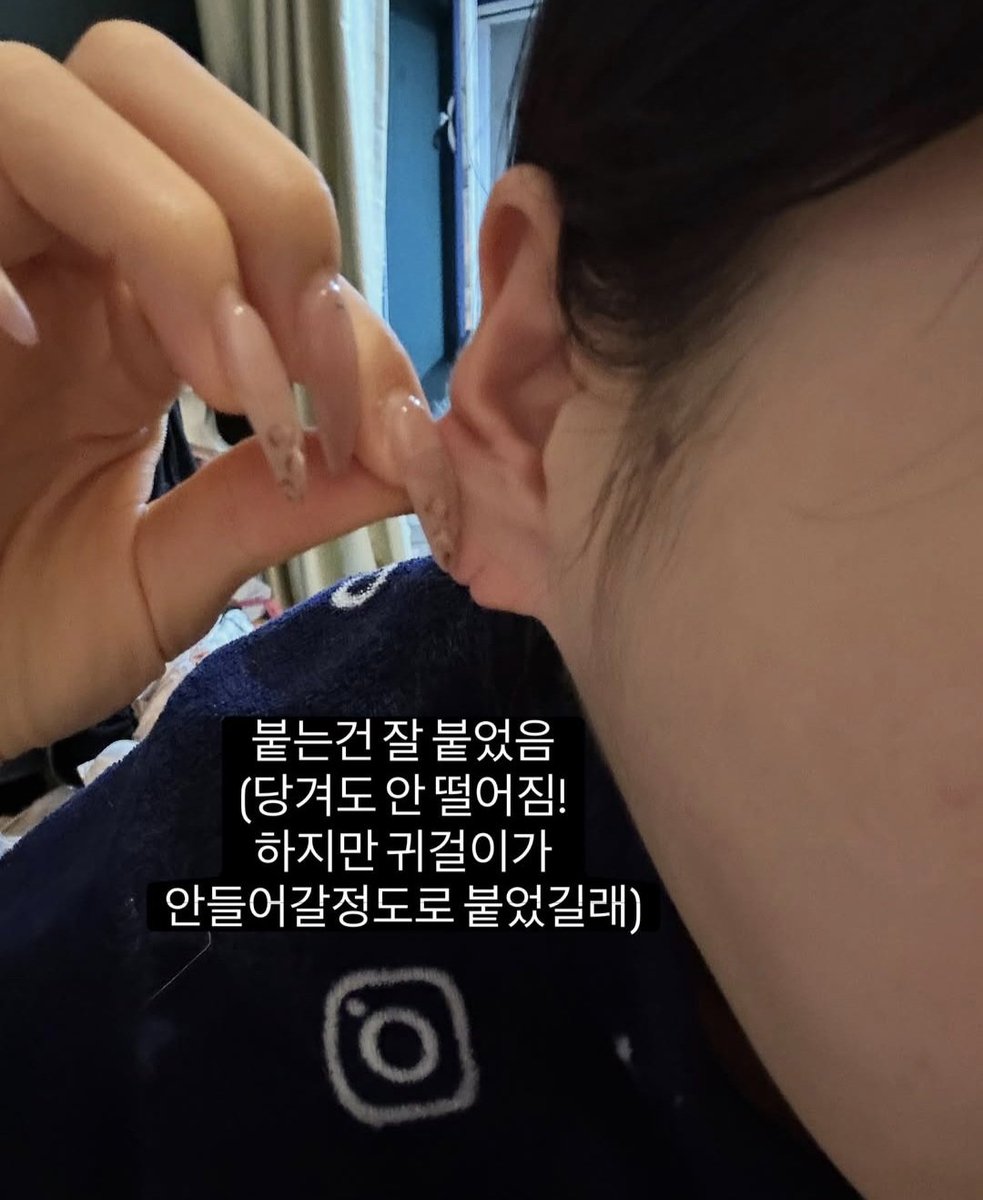 Whyif_Me_485's tweet photo. 에이 설마 하고 찾아봤는데 이분 지금 귀 붙었는데 귀걸이 안 들어간다고 다시 뜯고 귀걸이랑 같이 붙였다고 함
난 류라이씨 별 생각 없는데 가끔 이런 안전상의 기행을 저지르실 땐 진심으로 걱정 됨... https://t.co/dgIvjv0Utb