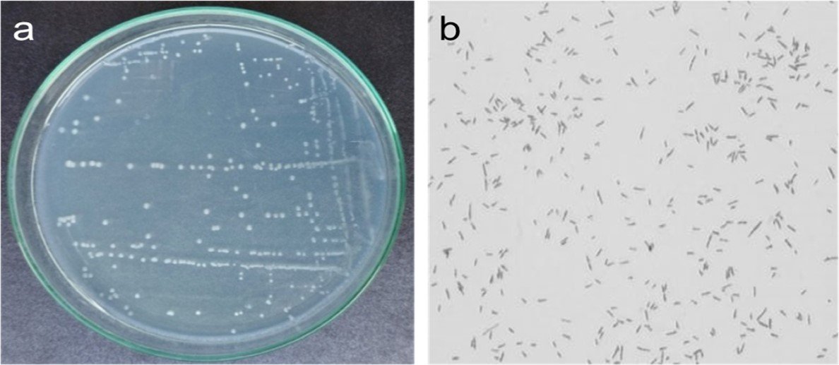 JabetEditor's tweet photo. Efficacy of soil-borne Burkholderia Cepacia-like MB-01 strain for shobicron and vertimec degradation
#Antibioticsensitivity #Shobicron #Vertimec
#Degradation #Bacteria
https://t.co/yqr7tdg7qU https://t.co/sP9PbGeCpG