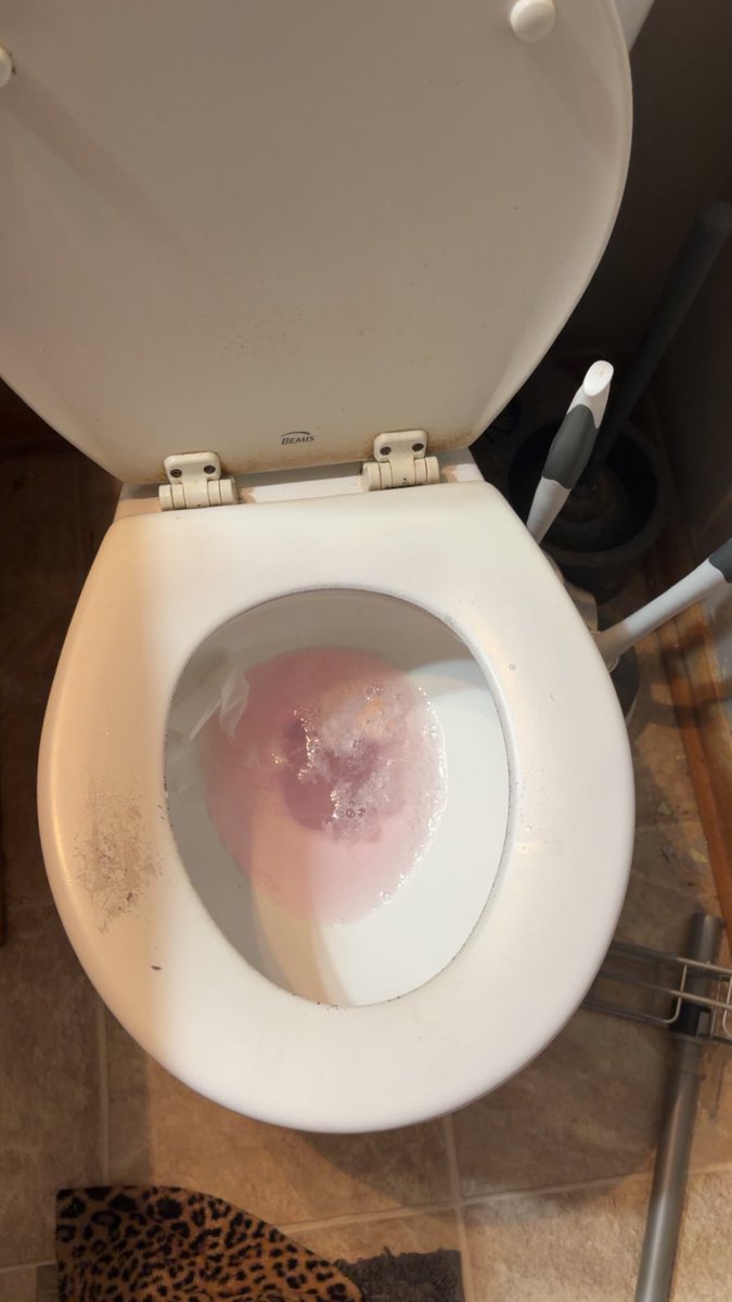 coveredinursoul's tweet photo. TW: puke
i js puked STRAIGHT pink https://t.co/2ACNdBV3Ky