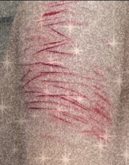 sleepwcyanide's tweet photo. practicing my sfx makeup for halloween ✨♥️

#shtwt #goretwt https://t.co/Cp5o9jrdAc
