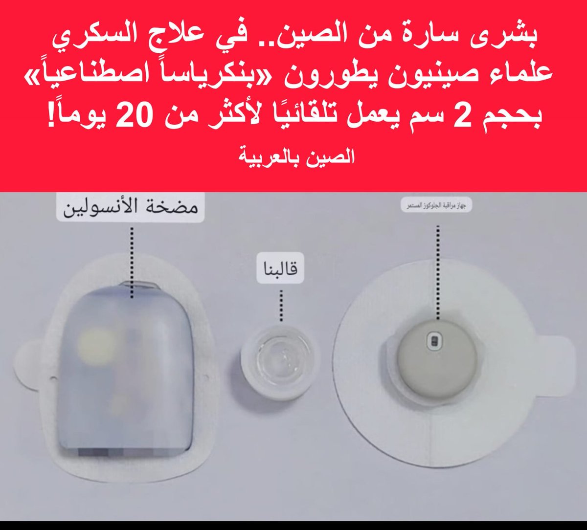 mog_china's tweet photo. 🇨🇳
🔴 غير عادي وبشرى سارة

علماء صينيون يصنعون "بنكرياس" اصطناعيًا

طور علماء صينيون جهازاً يمكن ارتداؤه، يجمع بين مستشعر لمستوى الجلوكوز ومضخة صغيرة لتوصيل الأنسولين.

يتفاعل النموذج الأولي تلقائياً مع ارتفاع نسبة السكر في الدم، ويمكن التحكم فيه عبر الهاتف الذكي.
 يبلغ قطره حوالي 2 سم، وهو أصغر من المضخات وأجهزة المراقبة المتوفرة في السوق.

وفقاً للباحثين، يمكن للجهاز أن يعمل لأكثر من 20 يوماً. 
كانت فعالية توصيل الأنسولين في التجارب مماثلة للحقن التقليدية. 
ومع ذلك، فقد تم اختبار الجهاز حتى الآن فقط على الفئران المصابة بداء السكري من النوع الأول.