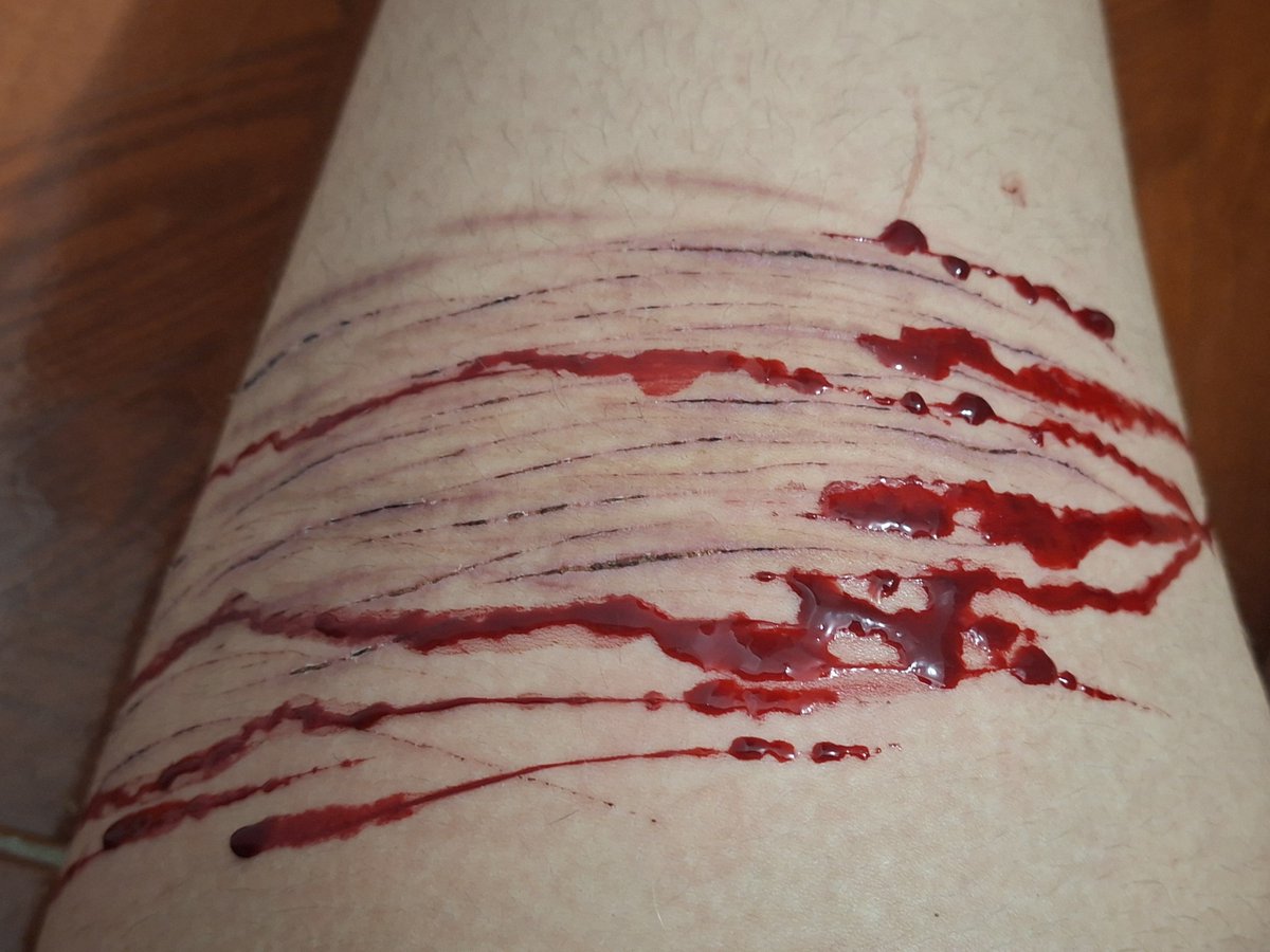 tzarent89010's tweet photo. 🩷🌷🩹 

#𝐒𝐡 #𝐒𝐡𝐭𝐰𝐭 #𝐒𝐞𝐥𝐟𝐇𝐚𝐫𝐦 #Fake #𝐁𝐥𝐨𝐨𝐝 #MAKEUP #𝐒𝐡𝐞𝐝𝐭𝐰𝐭 ♡
⚠️¡¡¡FAKE BLOOD!!! ¡¡MAKEUP!! ⚠️ https://t.co/ZZAHnEFfLN