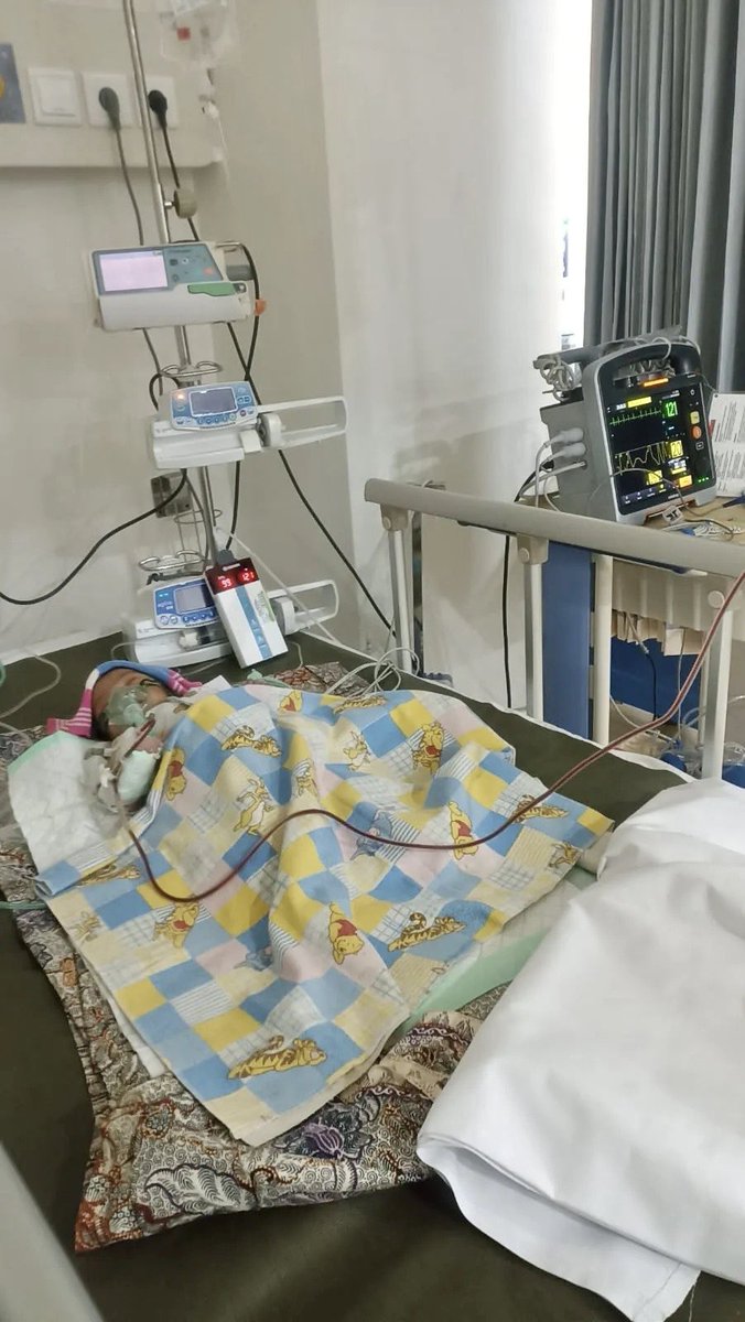 sehyrui's tweet photo. UPDATE & KRONOLOGI baby Alena :

sudah 2 hari ini kondisi adik Alena masih Kritis 🥹 neneknya itu dari pihak Ayah si bayi, alias Mertua si ibu bayi 😭

kronologi yg aku baca dari akun onty bayi : 
si bayi ini lagi demam, nah posisinya ibu bayi lagi makan, jadi si bayi digendong sama neneknya. di cekokin lah telur mentah, ngide biar demamnya turun 😭