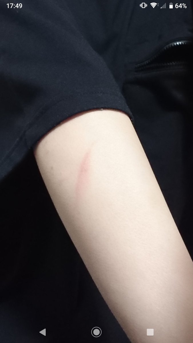 rio_room's tweet photo. 一昨日アイロンに当たってジュっとやってしまったのよ😭パッと見リストカットじゃん…まだまだ暑い日もあるから嫌なのよね、これ。完全に消えるかな？傷残りやすい人間だからな😗 https://t.co/PiQdXNCVp2