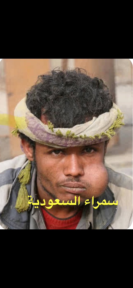 Hilalm5bd's tweet photo. @AnoudOtaibi_pro العنود العتيبي في معلفه 👇🏿 https://t.co/wbYLIrpUTN