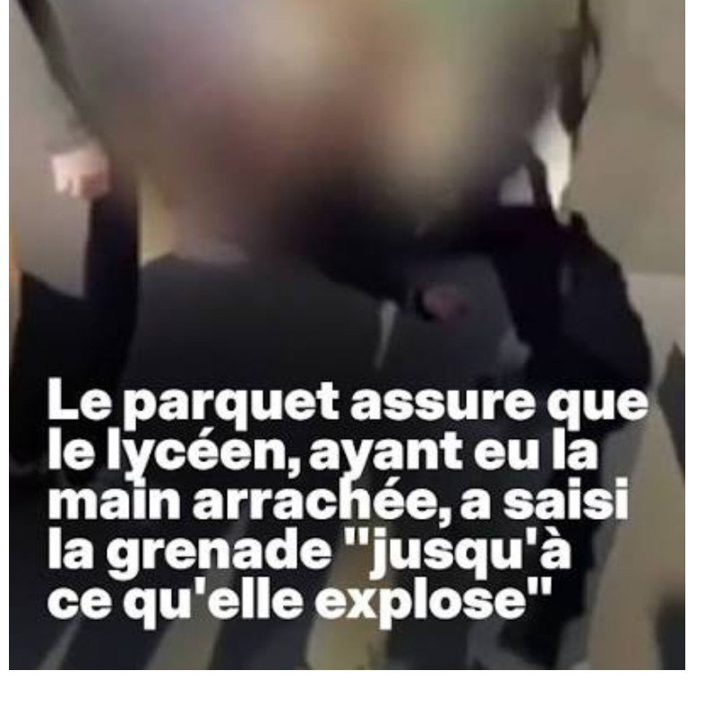 gauchecaca's tweet photo. Quelle surprise!
Le jeune qui a eu la main arrachée par une grenade assourdissante à Lens l'avait saisie  juste avant l'explosion.
Pour la renvoyer sur les flics, certainement.
Ceux qui ont parlé de violences policières savaient . Seul "basic gaucho" peut en douter.

Un mot? https://t.co/JX6Ay4gB5U