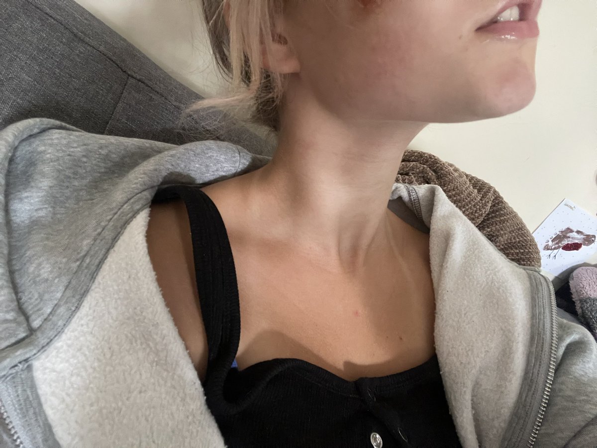 pivkosaur's tweet photo. Jaw mogging, natural tan mogging, try and outmog me https://t.co/XbHNGg1GGO