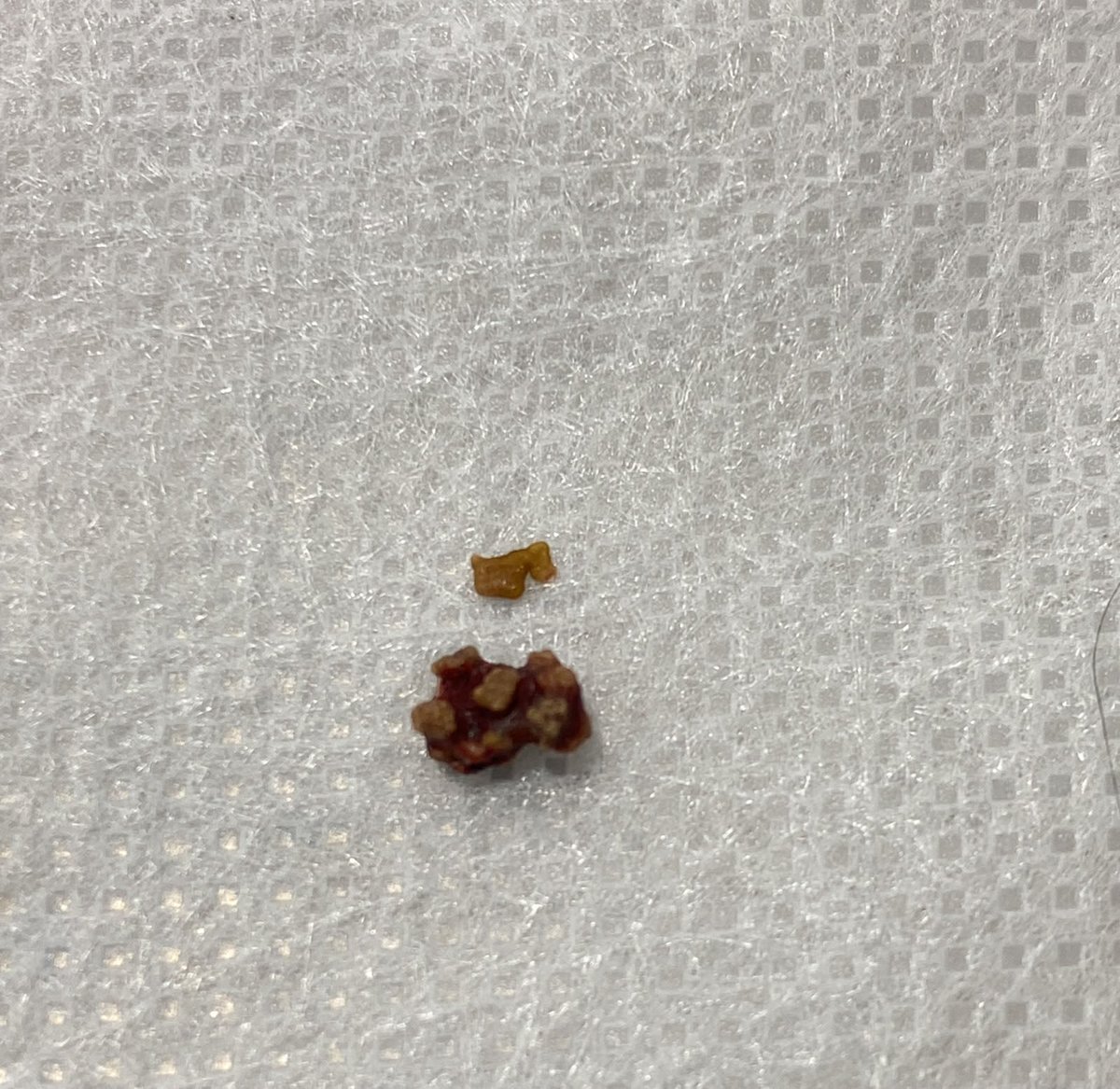 Soldier_BRZ's tweet photo. ❤️ Tamago foi operado de urgência e está se recuperando bem! Obrigada a todos que ajudaram a salvar sua vida! 🙏

Faltam R$ 890 para pagar a cirurgia e ainda tenho +R$ 3 mil parcelados da internação anterior.

Qualquer ajuda importa! ❤️

Pix: 07164765413 https://t.co/A0WZszP43v